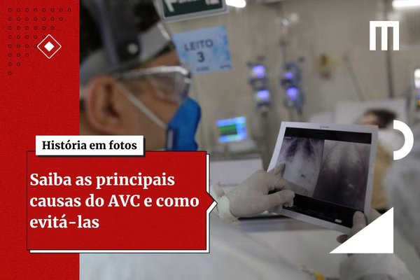 Exame de vista comum pode prever risco de AVC, mostra estudo