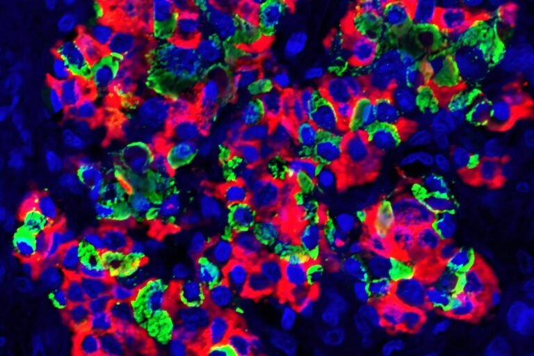 Transplante de ilhotas controla diabetes tipo 1 em animais, diz estudo Transplante de ilhotas controla diabetes tipo 1 em animais, diz estudo
