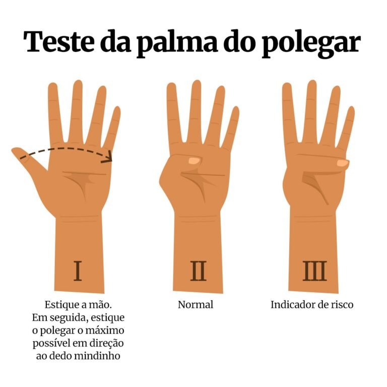 Vídeo: médico ensina truque com dedo que avalia risco de aneurisma Vídeo: médico ensina truque com dedo que avalia risco de aneurisma