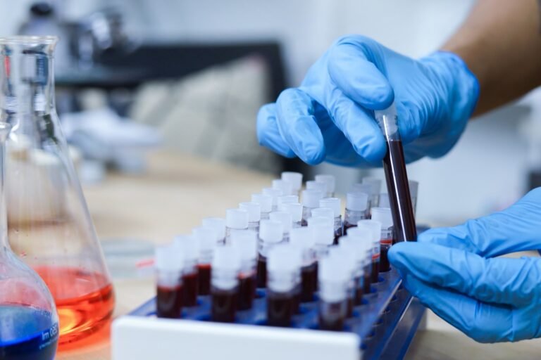 Gwada negativo: cientistas descobrem novo grupo sanguíneo Gwada negativo: cientistas descobrem novo grupo sanguíneo