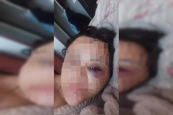 Homem que ameaçou e agrediu companheira desmaiada em escada é preso