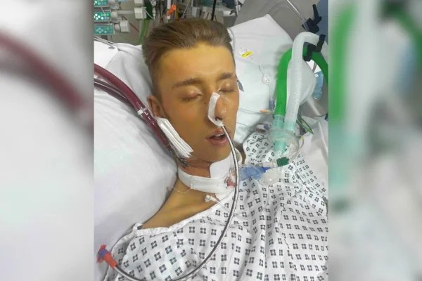 Jovem que achava ter gripe descobre quadro grave e perde as 2 pernas