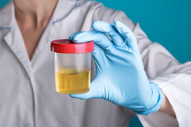 Proteína presente na urina pode sinalizar risco de demência