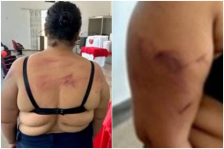 Veja lesões de mulher com bebê no colo atacada a facão pelo marido
