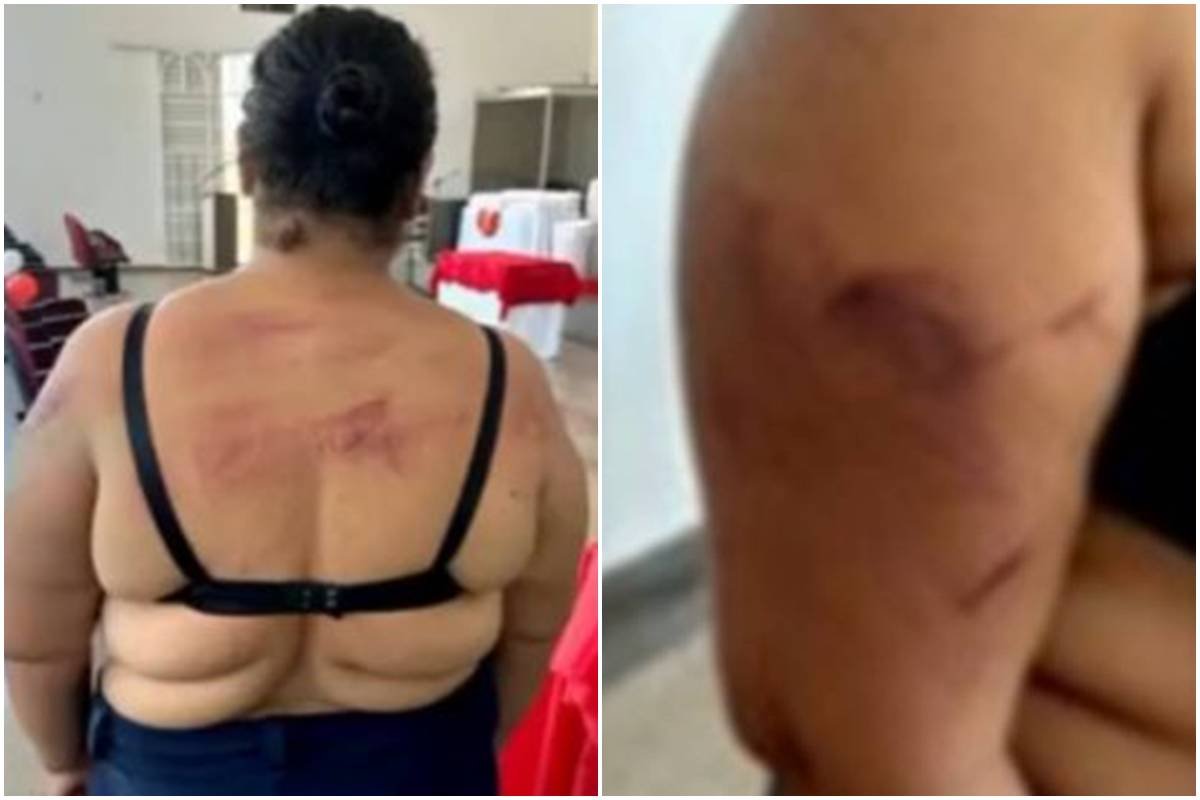 Veja lesões de mulher com bebê no colo atacada a facão pelo marido