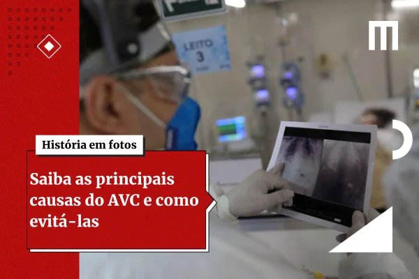 AVC: jovem de 20 anos relata único sintoma que sentiu antes de derrame