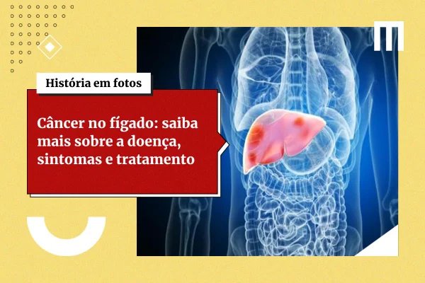 Câncer de fígado: mudança de hábitos pode prevenir até 60% dos casos