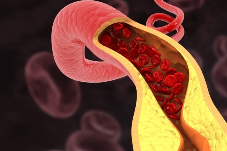 Cardiologistas apontam hábitos que ajudam a "limpar” as artérias
