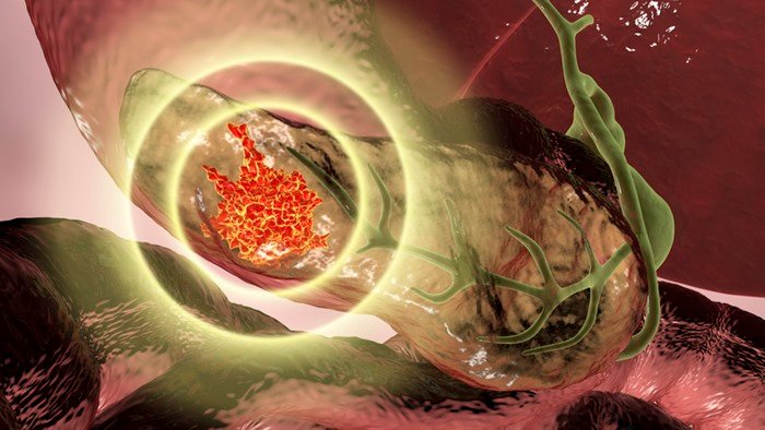 Mulher é diagnosticada com câncer terminal às 32 semanas de gestação