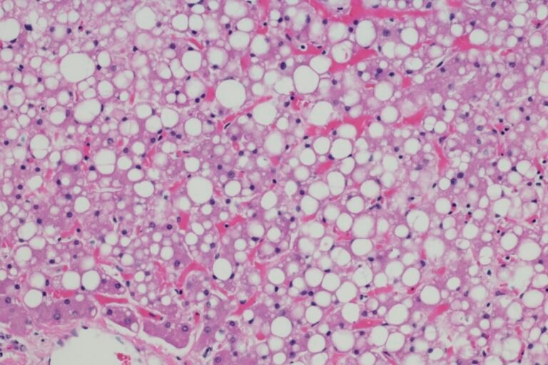 sintomas e como é feito o tratamento da condição