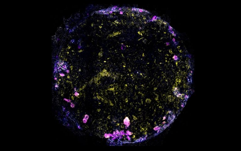 Cientistas criam minipulmão para estudar como a tuberculose o infecta