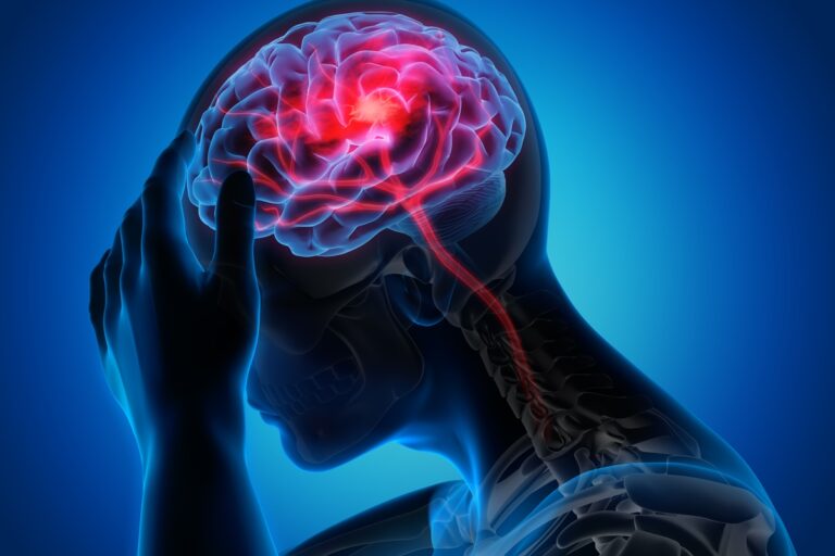 Neurologistas explicam quais são as sequelas mais comuns do AVC