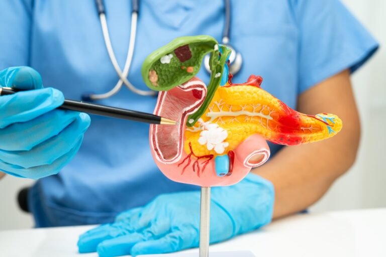 Nova descoberta dá esperança para o tratamento de câncer de pâncreas