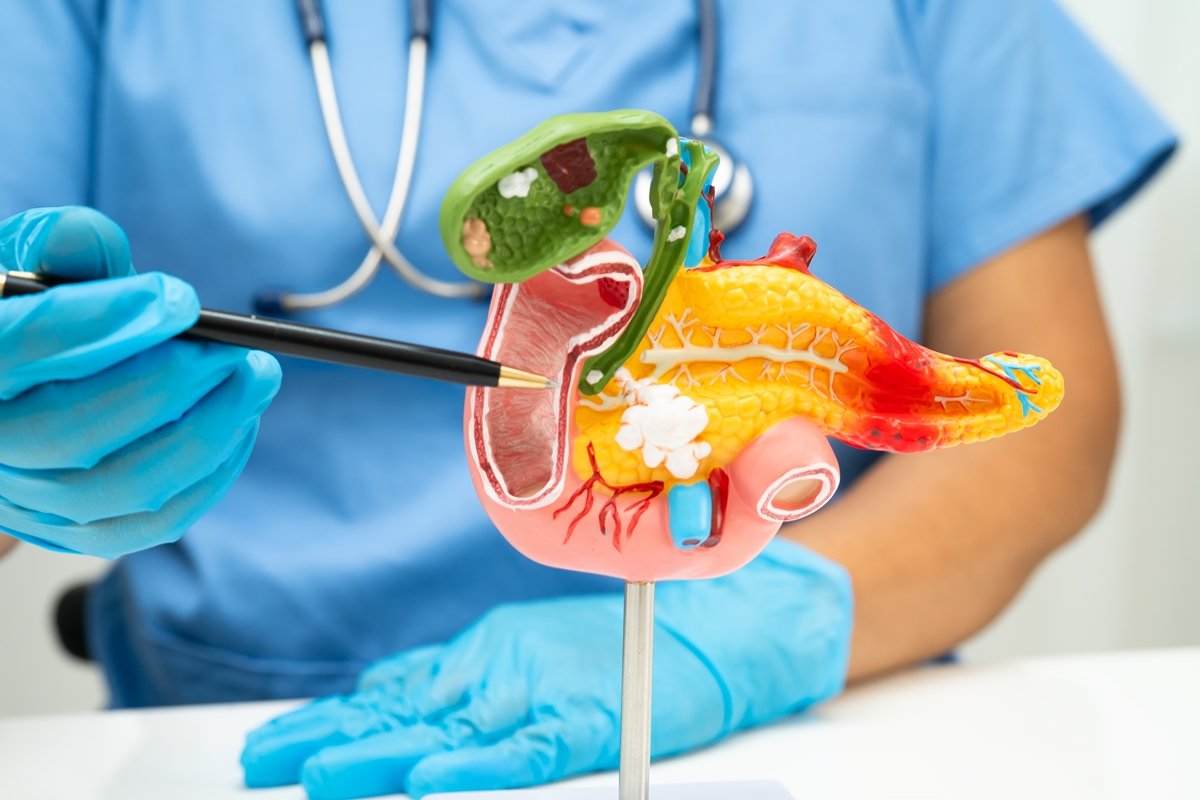 Nova descoberta dá esperança para o tratamento de câncer de pâncreas