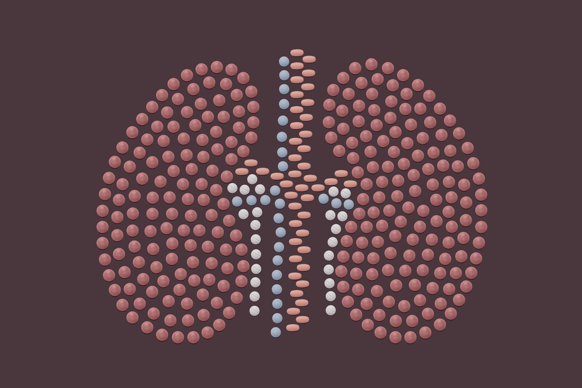 Remédio usado para artrite pode melhorar rins doados para transplante