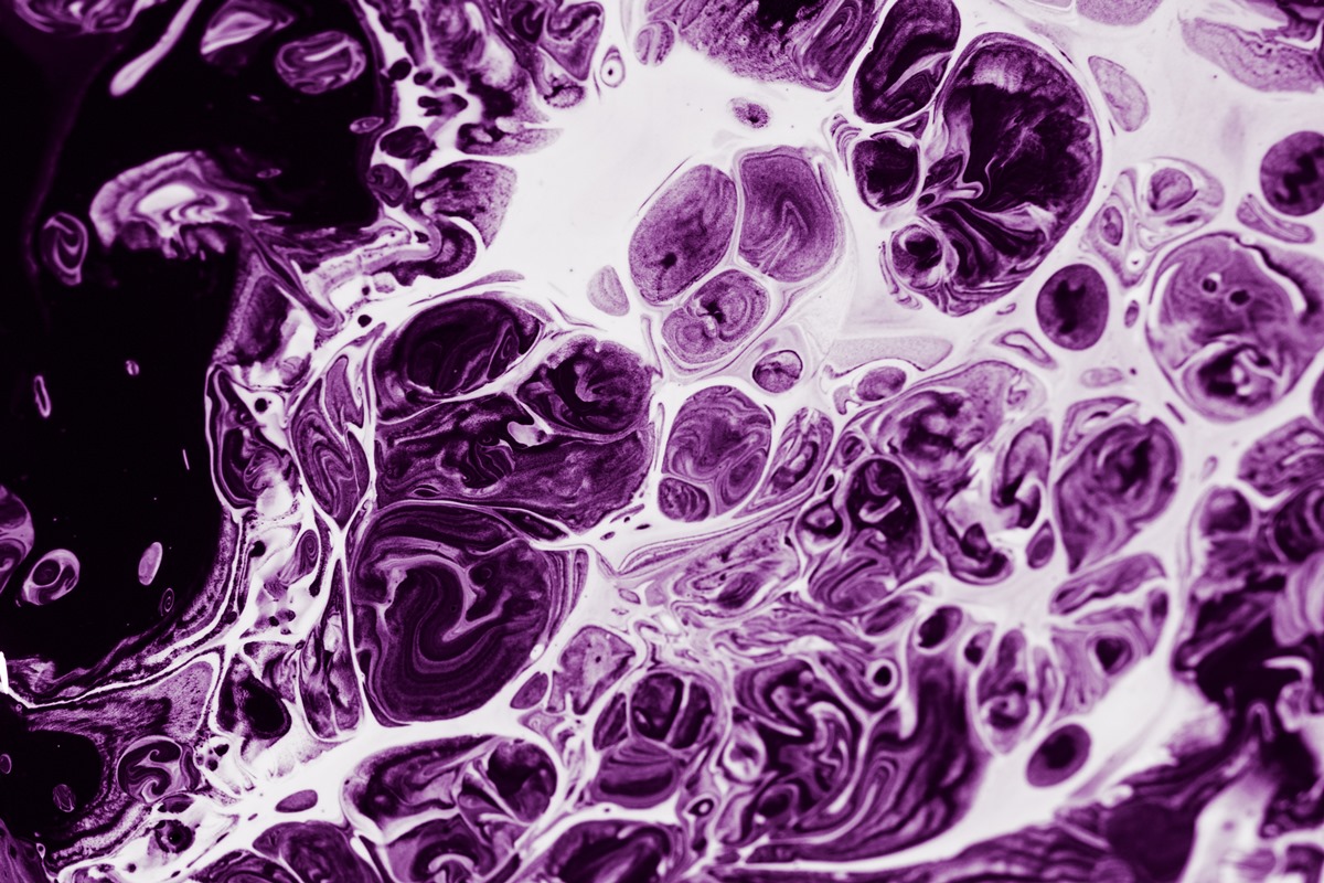 conheça o fungo que causou surto com morte nos EUA